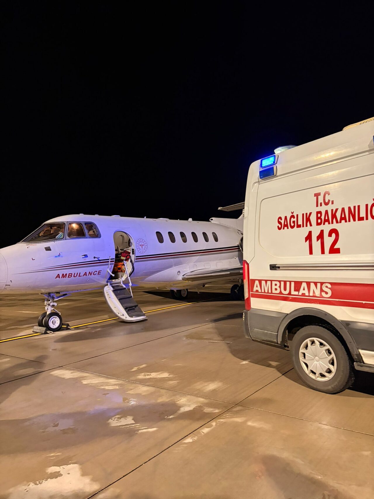 TOKAT (AA) – Tokat'ta kalp rahatsızlığı nedeniyle tedavi gören 18