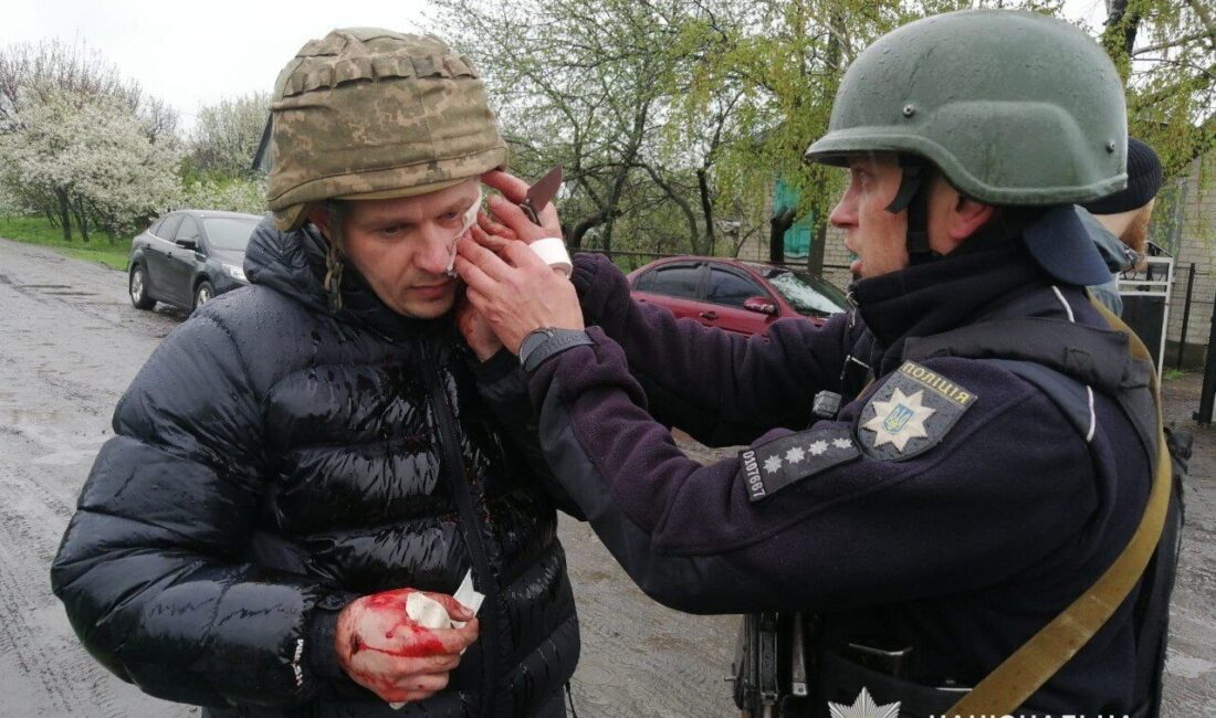 KİEV (AA) – Ukrayna'nın Dnipropetrovsk bölgesinde, bir kişinin güvenlik güçlerini