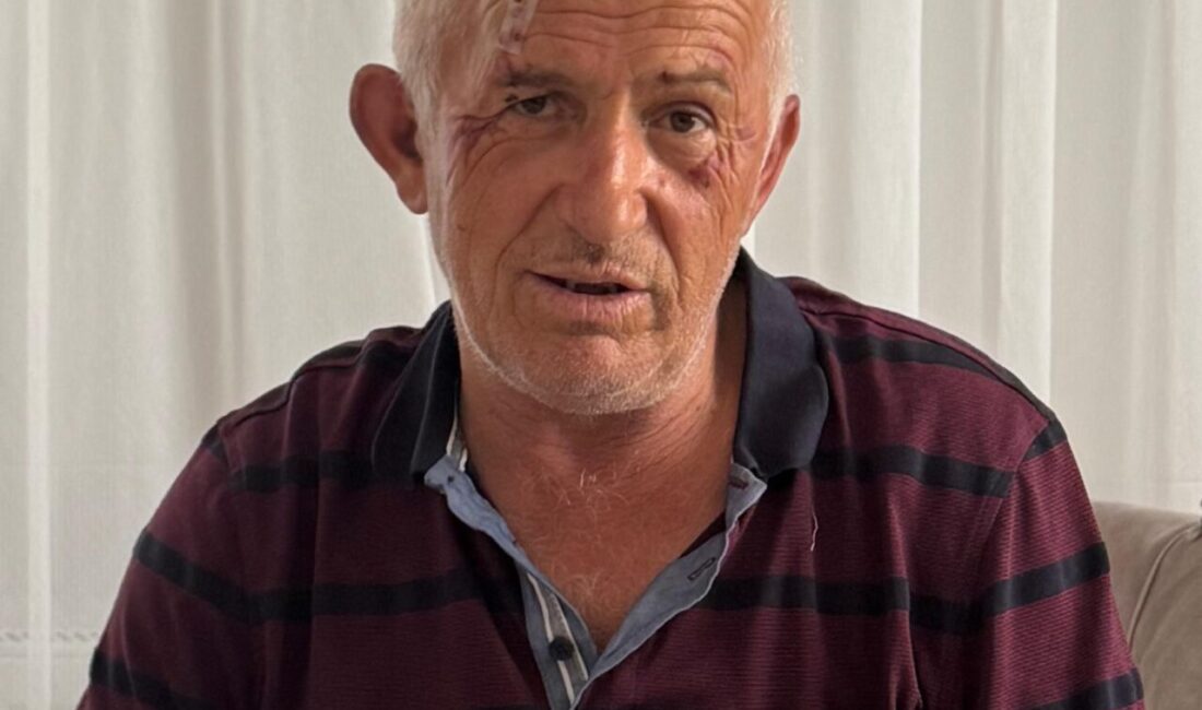 - Güce ilçesindeki kazada yaralanan kamyonetteki 2 kişi, tedavilerinin ardından