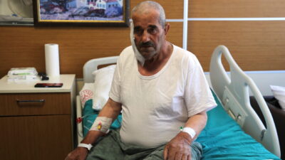 BİTLİS (AA) – Bitlis'in Ahlat ilçesinde yaşayan ve tükürük bezinde